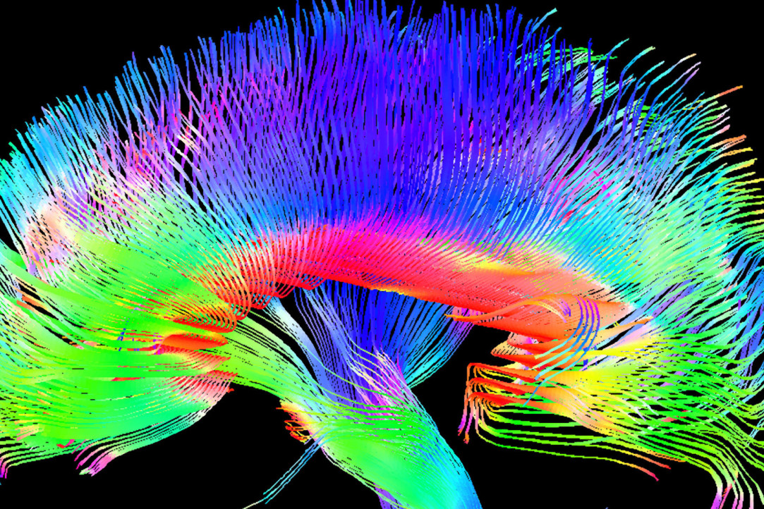 Первая в России лаборатория по социальным нейронаукам появится в НИУ ВШЭ